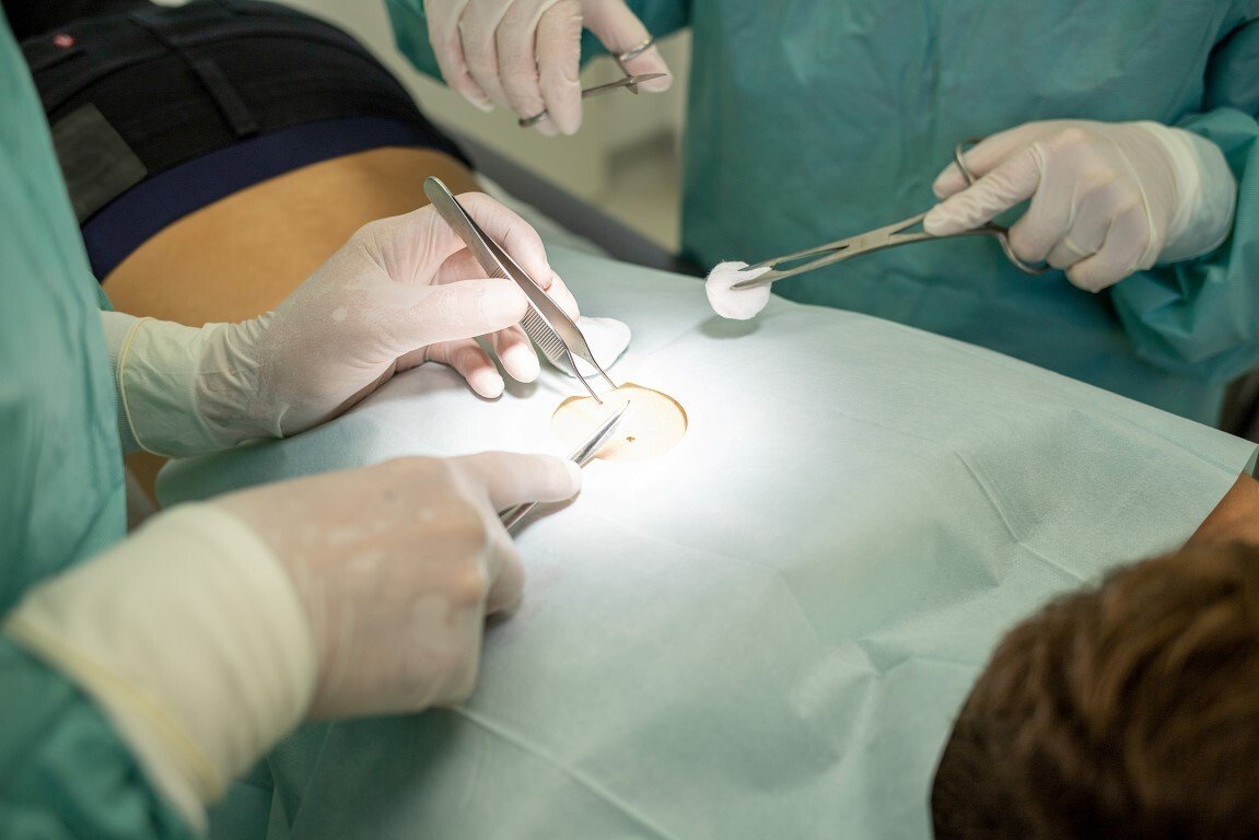 Hautbehandlungen | Bad Kissingen | Dr. med. Stefan Rickert